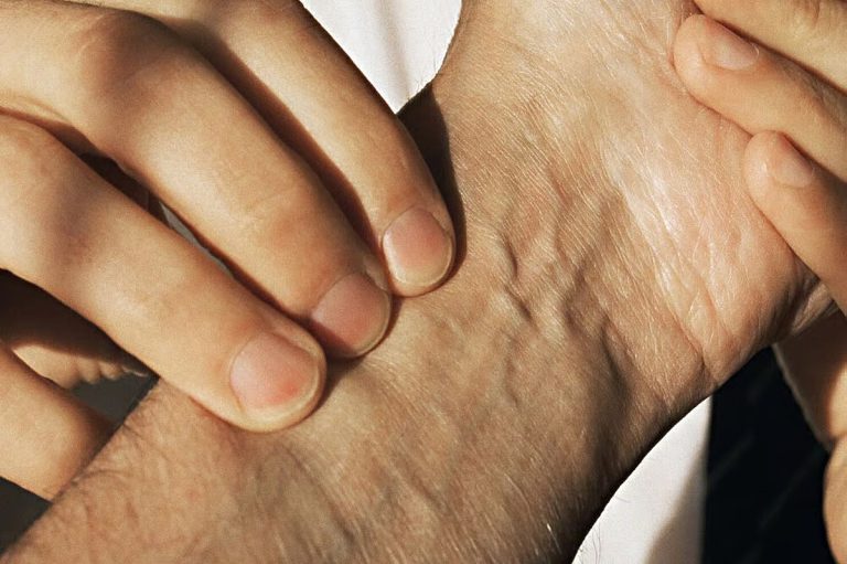 1000 1701691399 768x511